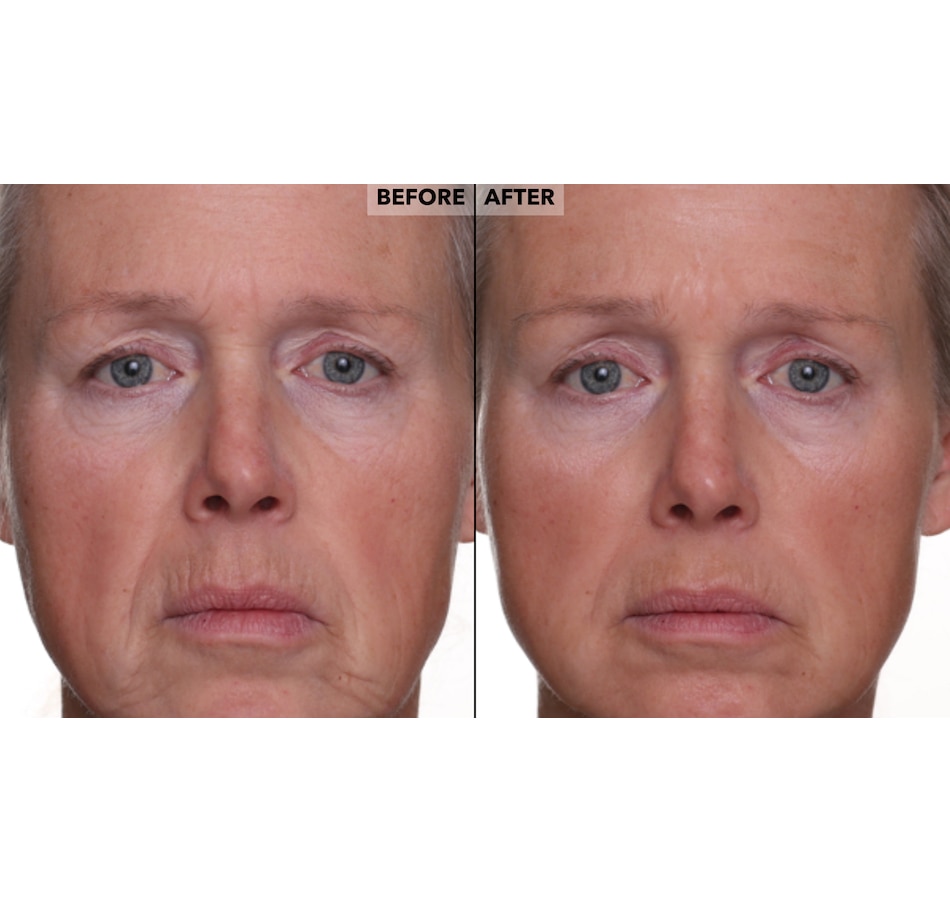 Image 400356_ALTMORE8.jpg, Product 400-356 / Price $49.50, Nakery Retinol + Collagen Cleanse, Repair & Treat Collection from Nakery Beauty on TSC.ca's Beauty department