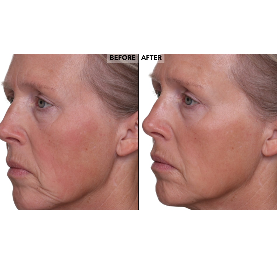 Image 400356_ALTMORE9.jpg, Product 400-356 / Price $49.50, Nakery Retinol + Collagen Cleanse, Repair & Treat Collection from Nakery Beauty on TSC.ca's Beauty department