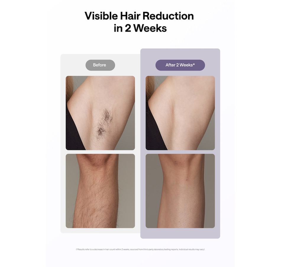 Image 627731_ALTMORE13.jpg, Product 627-731 / Price $418.99, Ulike Air 10 IPL Hair Removal Device from Ulike on TSC.ca's Beauty department