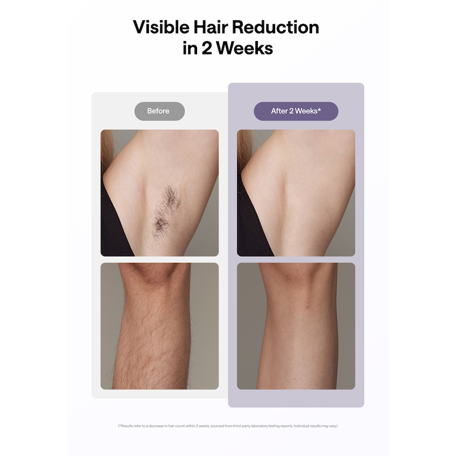 Image 627731_ALTMORE13.jpg, Product 627-731 / Price $399.99, Ulike Air 10 IPL Hair Removal Device from Ulike on TSC.ca's Beauty department