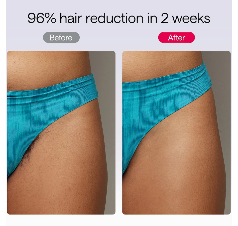 Image 627731_ALTMORE17.jpg, Product 627-731 / Price $418.99, Ulike Air 10 IPL Hair Removal Device from Ulike on TSC.ca's Beauty department