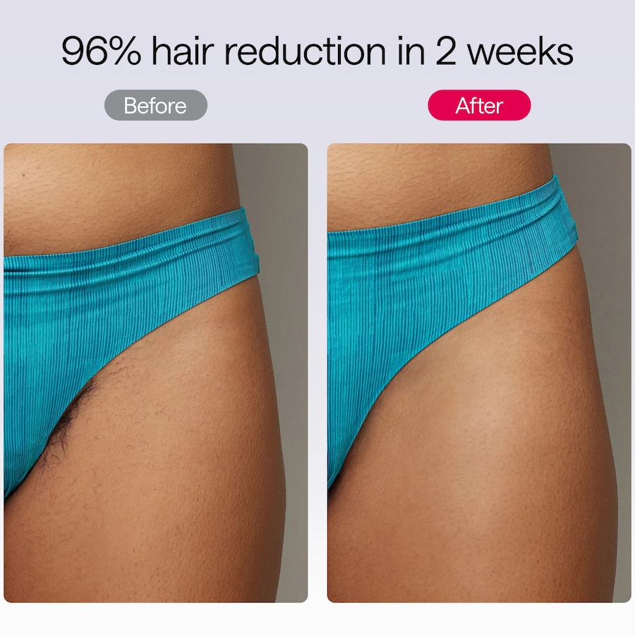 Image 627731_ALTMORE17.jpg, Product 627-731 / Price $399.99, Ulike Air 10 IPL Hair Removal Device from Ulike on TSC.ca's Beauty department