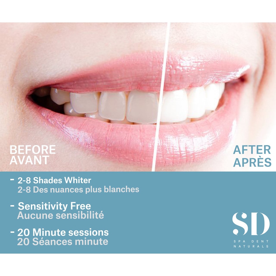 Image 707899_ALTMORE3.jpg, Product 707-899 / Price $152.00, Spa Dent Naturals Your Dentist At Home Smile Makeover Bundle 2.0 from Spa Dent SD Naturals on TSC.ca's Beauty department