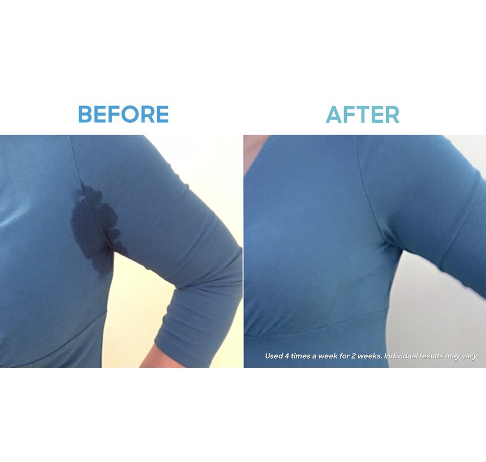 Image 707928_ALTMORE22.jpg, Product 707-928 / Price $619.00, Dermadry Total from Dermadry on TSC.ca's Health & Fitness department