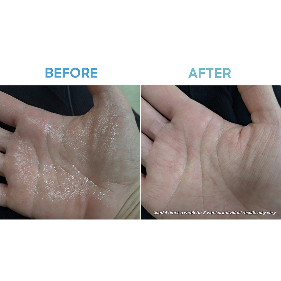 Image 707929_ALTMORE8.jpg, Product 707-929 / Price $599.00, Dermadry Hands & Feet from Dermadry on TSC.ca's Health & Fitness department