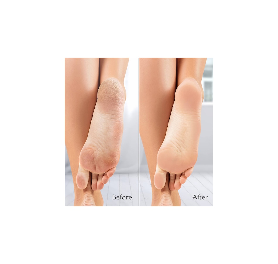 Image 707952_ALTMORE3.jpg, Product 707-952 / Price $99.00, Silk'N Vacupedi Limited Edition from Silk'n on TSC.ca's Beauty department