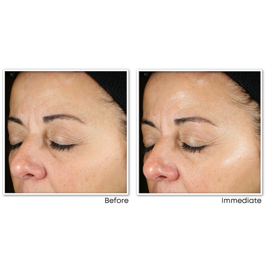 Image 714234_ALTMORE10.jpg, Product 714-234 / Price $49.99, RoC Multi Correxion Revive + Glow Daily Serum from RoC Skincare on TSC.ca's Beauty department
