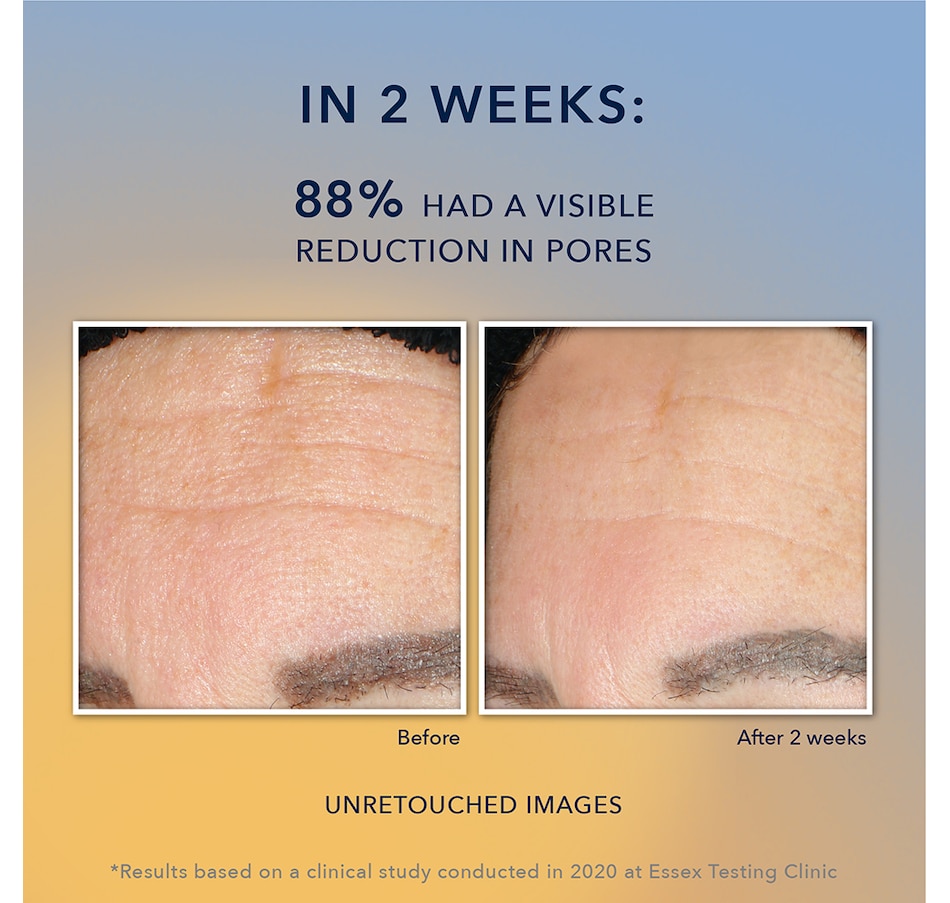 Image 714236_ALTMORE6.jpg, Product 714-236 / Price $17.99, Roc Multi Correxion Revive + Glow Gel Cleanser 177ml from RoC Skincare on TSC.ca's Beauty department