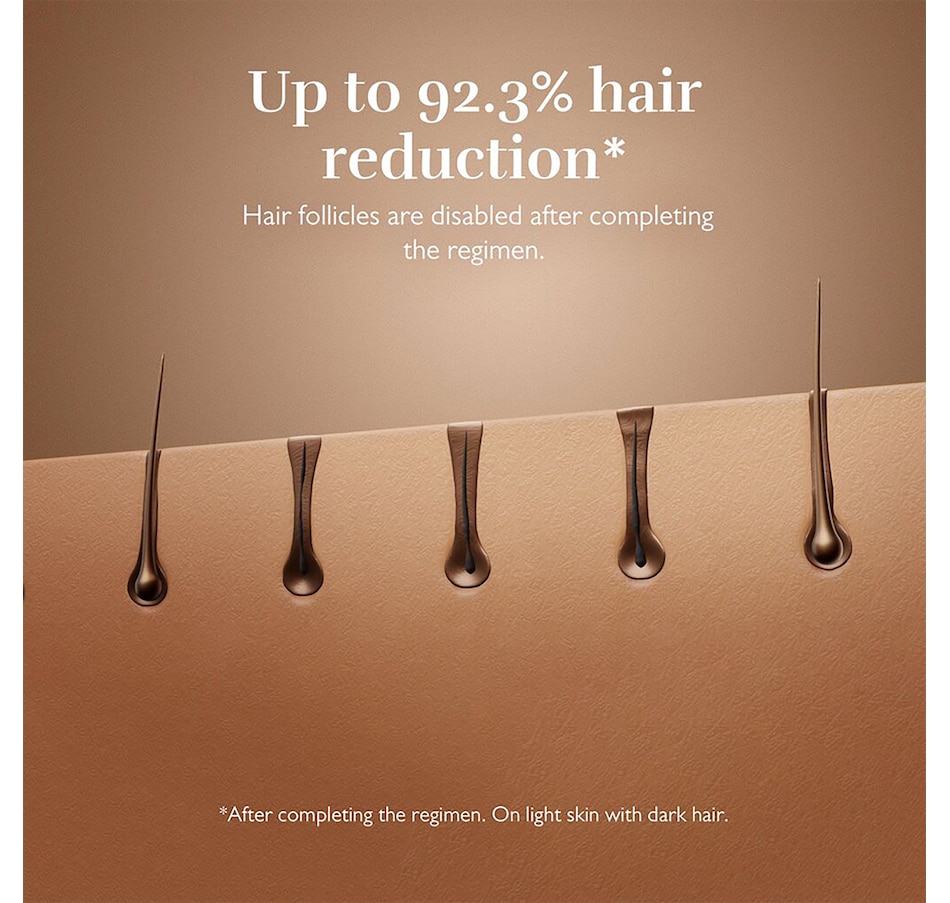 Image 728725_ALTMORE8.jpg, Product 728-725 / Price $599.00, Silk'n 7 from Silk'n on TSC.ca's Beauty department