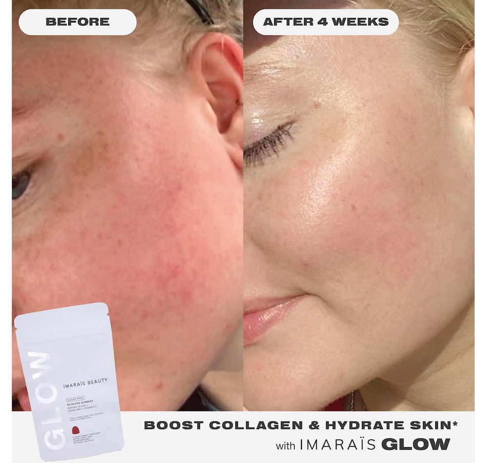 Image 752575_ALTMORE5.jpg, Product 752-575 / Price $29.99, IMARAIS Beauty Glow Skincare Gummies 30-count from IMARAÏS Beauty on TSC.ca's Health & Fitness department