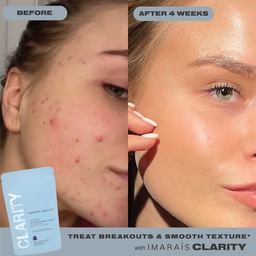 Image 752577_ALTMORE5.jpg, Product 752-577 / Price $29.99, IMARAIS Beauty Clarity Anti-Blemish Skincare Gummies 30-count from IMARAÏS Beauty on TSC.ca's Health & Fitness department