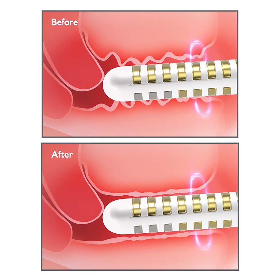 Image 752630_ALTMORE7.jpg, Product 752-630 / Price $298.99, Silk'n Tightra With 2 Electrodes Gels from Silk'n on TSC.ca's Health & Fitness department